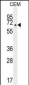 COX10 Antibody (C-term)